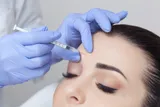 Dermal Fillers