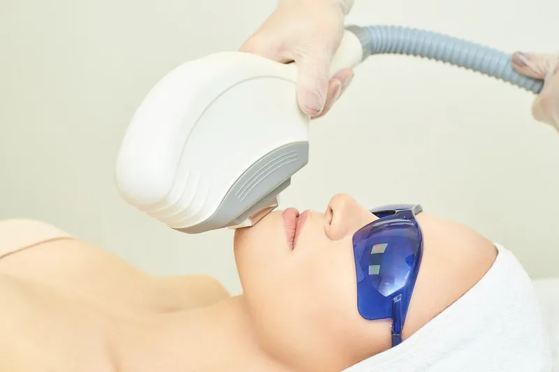 Laser Hair Reduction